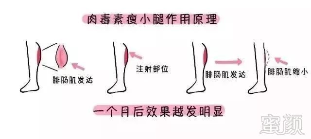 https://img.miyanlife.com/mnt/timg/180605/105A053L-6.jpg