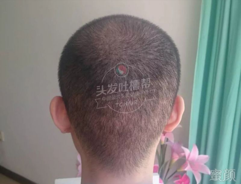 https://img.miyanlife.com/mnt/timg/180605/111Aa110-3.jpg