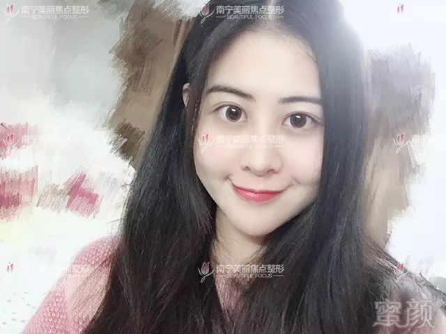 https://img.miyanlife.com/mnt/timg/180605/11221214c-10.jpg