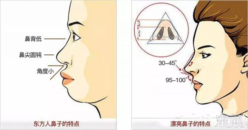https://img.miyanlife.com/mnt/timg/180605/11230K4K-1.jpg