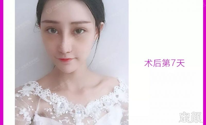 https://img.miyanlife.com/mnt/timg/180605/11232Jb4-12.jpg