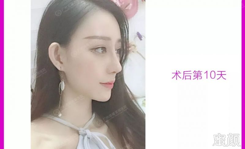 https://img.miyanlife.com/mnt/timg/180605/11232LX2-13.jpg