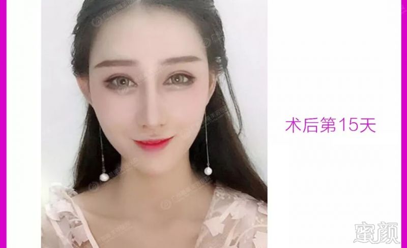 https://img.miyanlife.com/mnt/timg/180605/11232M025-14.jpg