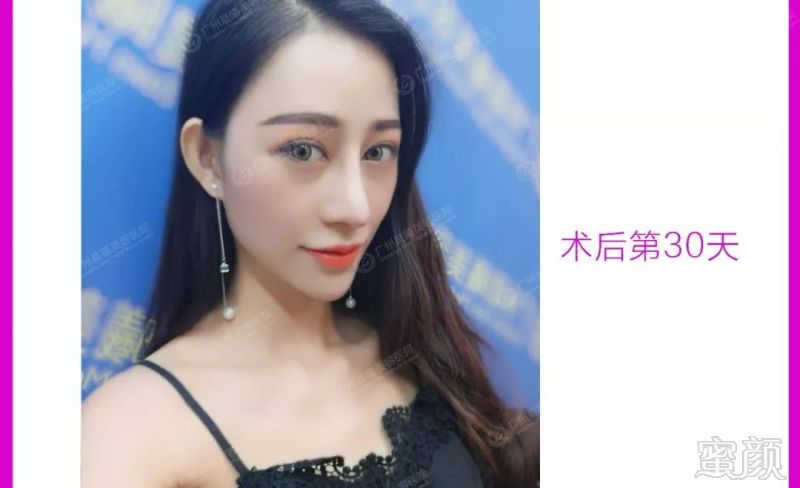 https://img.miyanlife.com/mnt/timg/180605/11232T401-15.jpg