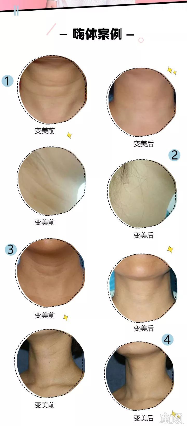 https://img.miyanlife.com/mnt/timg/180605/11302R295-7.jpg