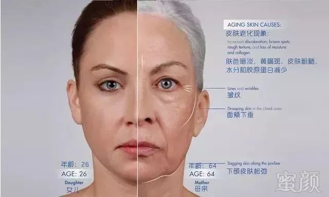案例图片