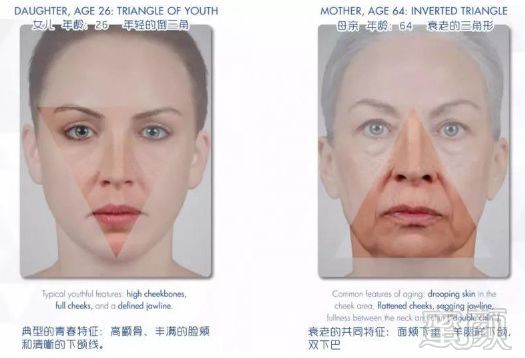 案例图片
