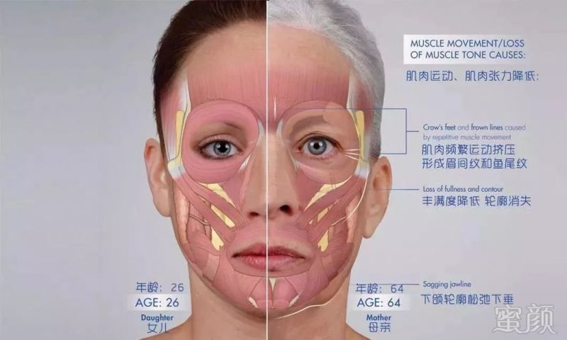案例图片