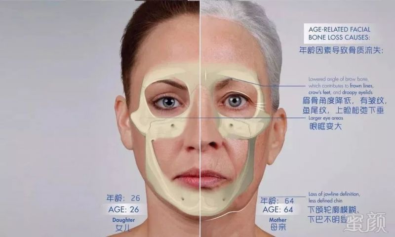 案例图片