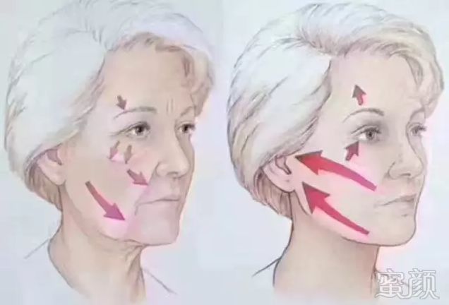 https://img.miyanlife.com/mnt/timg/180605/113231F20-8.jpg 案例图片