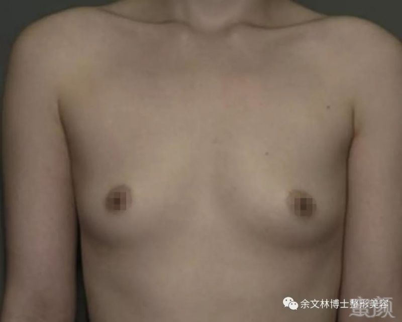 案例图片