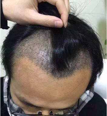 https://img.miyanlife.com/mnt/timg/180605/113RM424-1.jpg