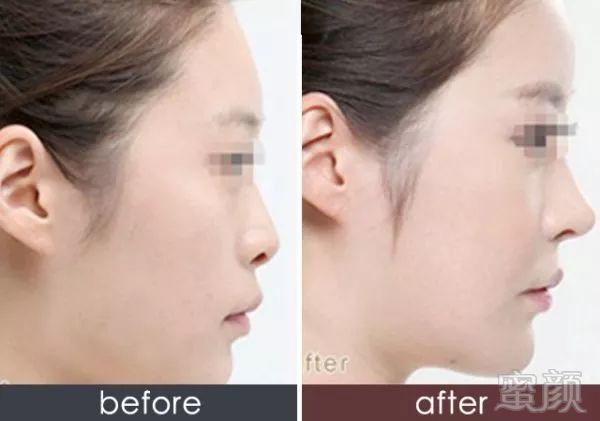 https://img.miyanlife.com/mnt/timg/180605/114R152J-2.jpg
