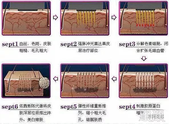 案例图片