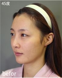 https://img.miyanlife.com/mnt/timg/180605/121PU403-0.jpg