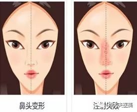 https://img.miyanlife.com/mnt/timg/180605/1306352G1-0.jpg