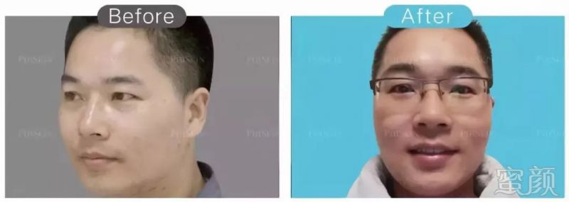 https://img.miyanlife.com/mnt/timg/180606/10542U3M-6.jpg