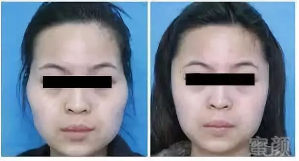 https://img.miyanlife.com/mnt/timg/180606/11110LP3-2.jpg
