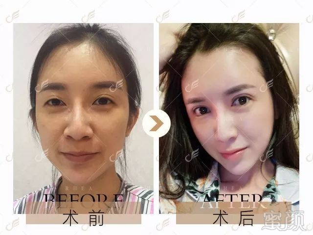 https://img.miyanlife.com/mnt/timg/180606/1131091I7-1.jpg