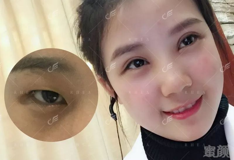 https://img.miyanlife.com/mnt/timg/180606/113110A21-2.jpg