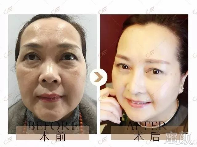 https://img.miyanlife.com/mnt/timg/180606/11311141B-3.jpg