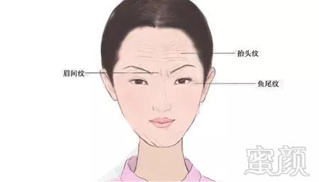 https://img.miyanlife.com/mnt/timg/180606/1131312Y2-4.jpg