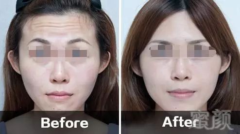 https://img.miyanlife.com/mnt/timg/180606/1131314T1-2.jpg