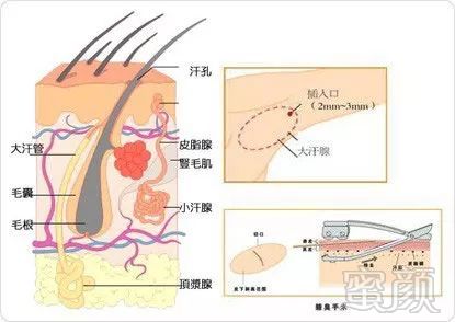 案例图片