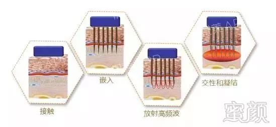 https://img.miyanlife.com/mnt/timg/180606/122Q93093-7.jpg