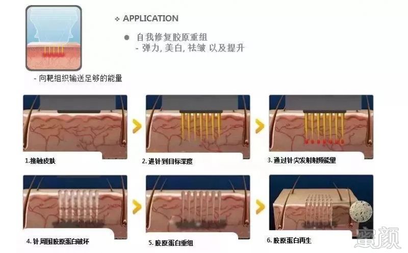 https://img.miyanlife.com/mnt/timg/180606/122R03H8-8.jpg