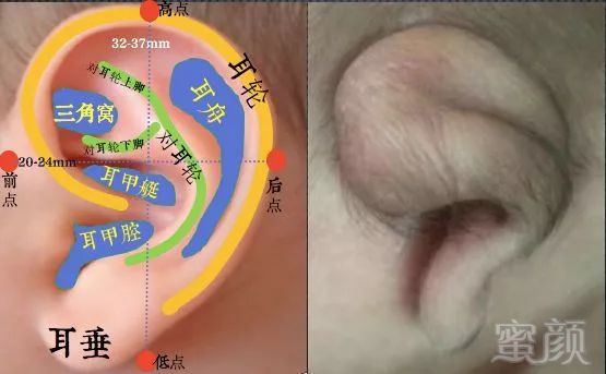 案例图片