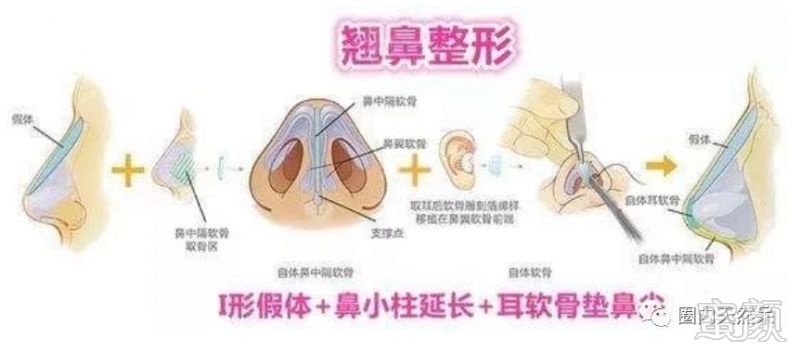 https://img.miyanlife.com/mnt/timg/180606/13463521R-3.jpg