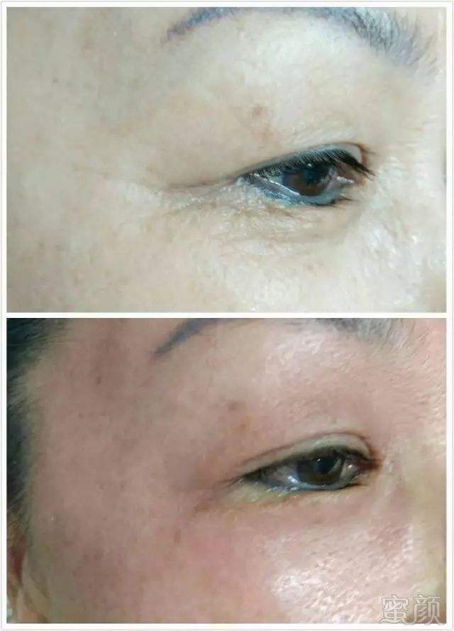 https://img.miyanlife.com/mnt/timg/180606/14002SF9-2.jpg