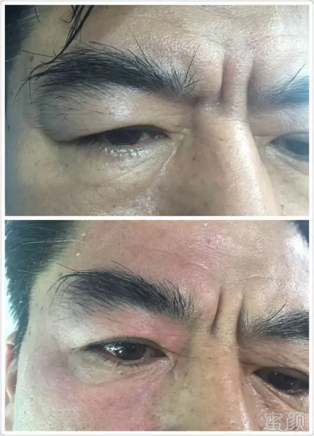 https://img.miyanlife.com/mnt/timg/180606/14002TW0-3.jpg