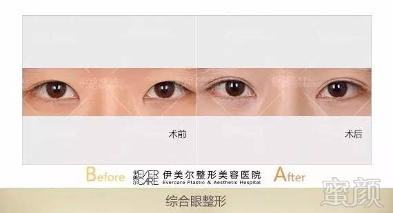 https://img.miyanlife.com/mnt/timg/180607/11102312T-8.jpg