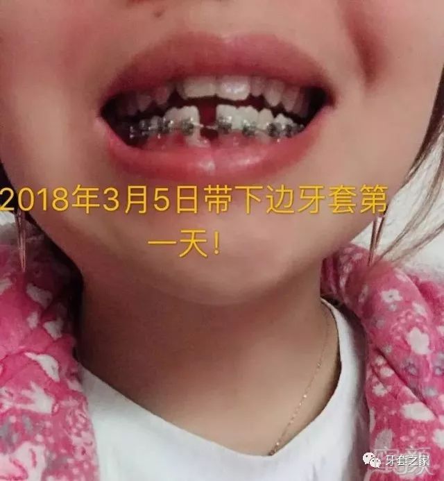 https://img.miyanlife.com/mnt/timg/180607/111HKY9-1.jpg