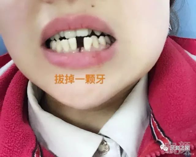 https://img.miyanlife.com/mnt/timg/180607/111HL263-0.jpg