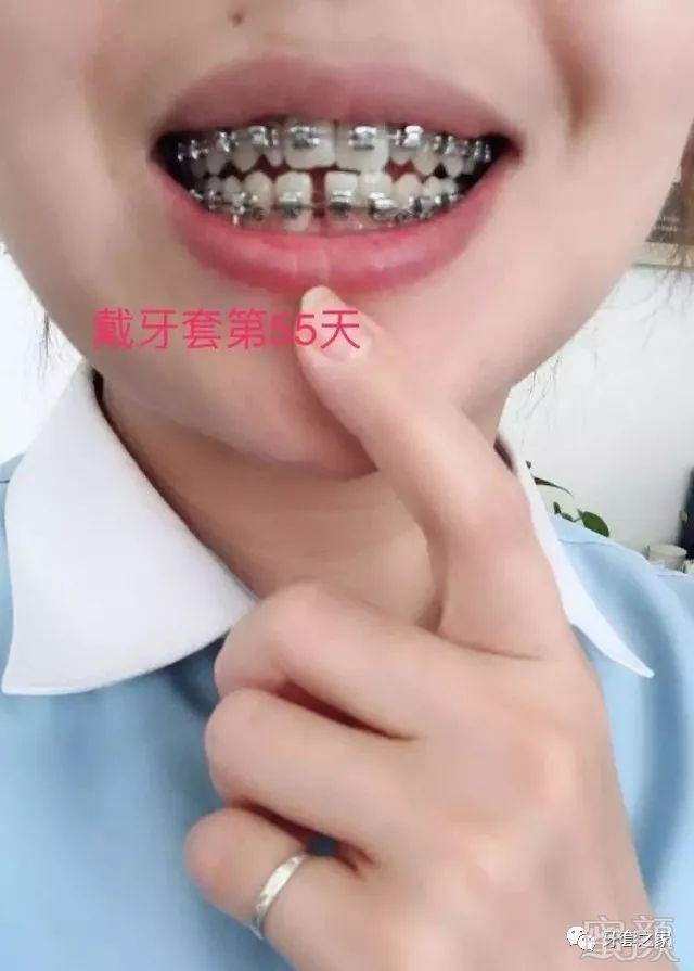 https://img.miyanlife.com/mnt/timg/180607/111HQ5b-3.jpg
