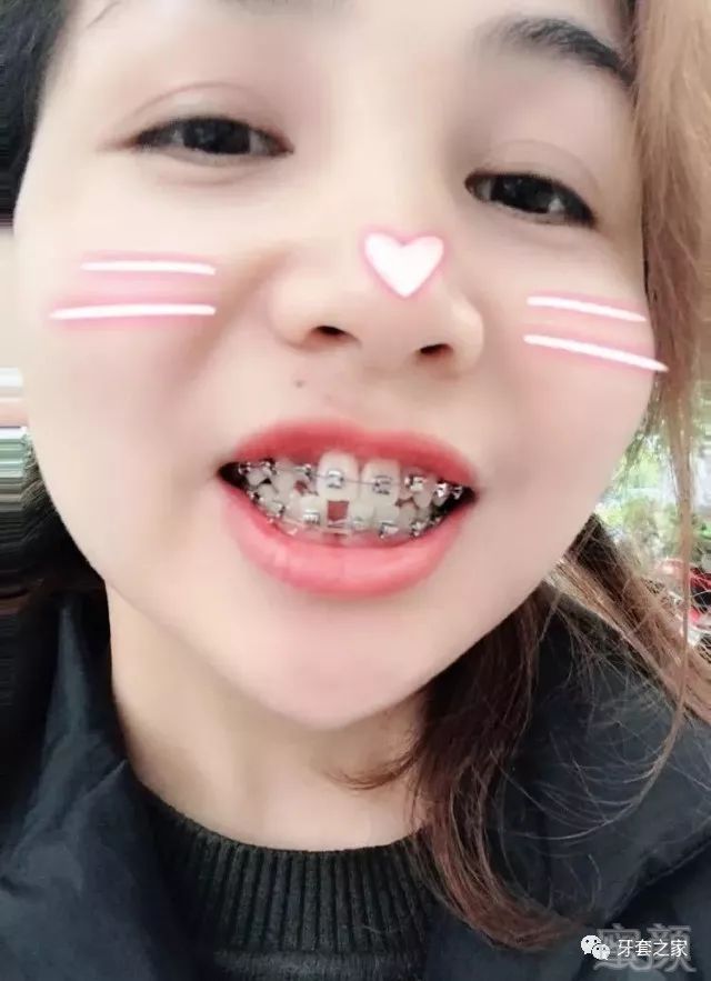 https://img.miyanlife.com/mnt/timg/180607/111HWU2-2.jpg