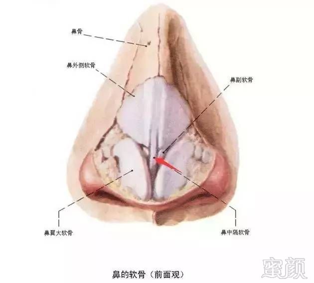 案例图片