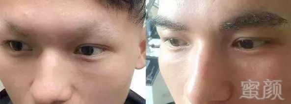 https://img.miyanlife.com/mnt/timg/180607/1241135F1-6.jpg
