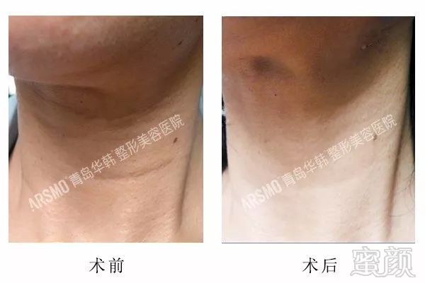 https://img.miyanlife.com/mnt/timg/180607/124I92144-12.jpg