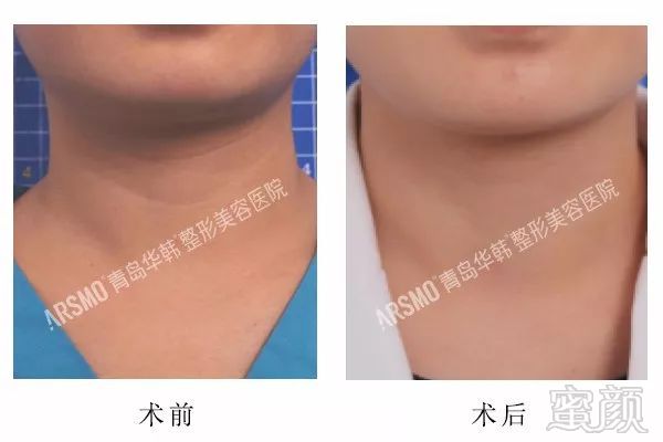 https://img.miyanlife.com/mnt/timg/180607/124I92563-11.jpg