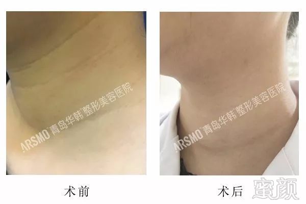https://img.miyanlife.com/mnt/timg/180607/124J020K-13.jpg