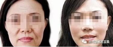 https://img.miyanlife.com/mnt/timg/180607/1251122X9-7.jpg