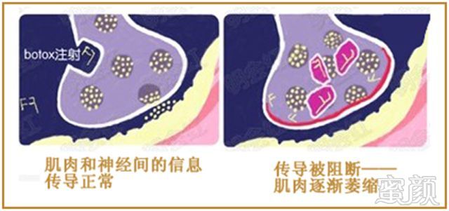 https://img.miyanlife.com/mnt/timg/180607/130RC2Q-0.jpg