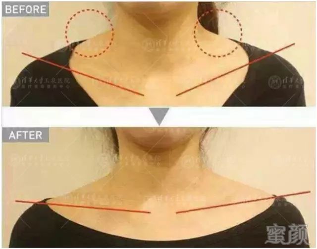 https://img.miyanlife.com/mnt/timg/180607/130RJ541-2.jpg