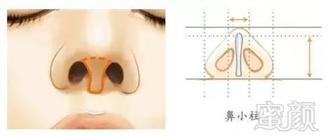 https://img.miyanlife.com/mnt/timg/180607/13140I617-3.jpg