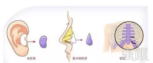 https://img.miyanlife.com/mnt/timg/180607/13140Q347-7.jpg