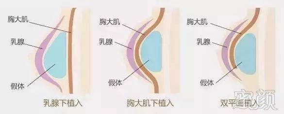 案例图片